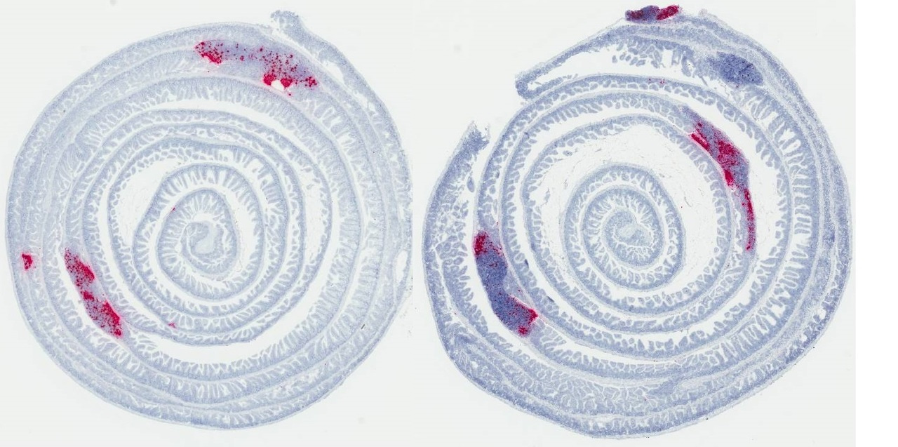 Elusive norovirus, finally found replicating in GALT immune cells